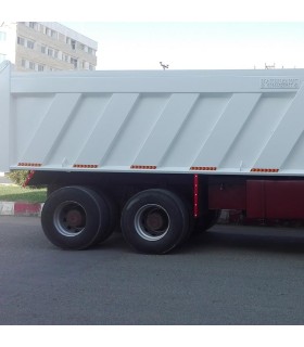 اتاق کمپرسی مایلری ایویکو